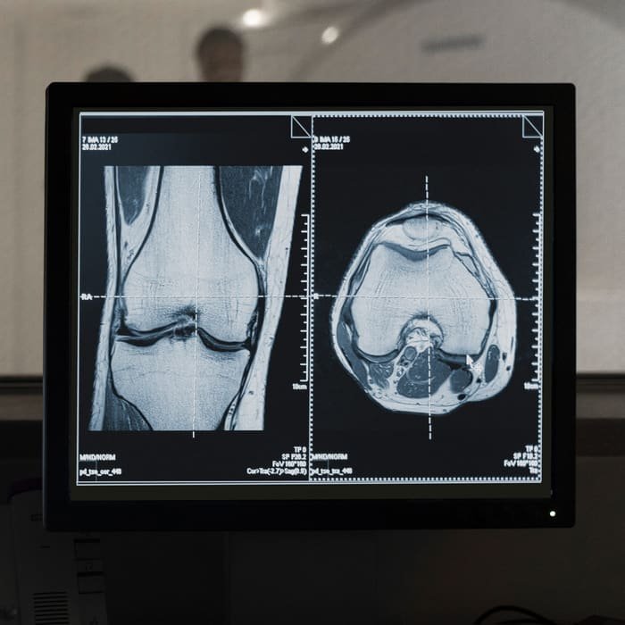 MRI tele-reporting