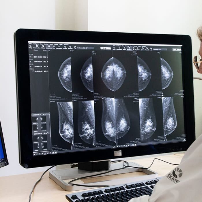 Mammography teleradiology