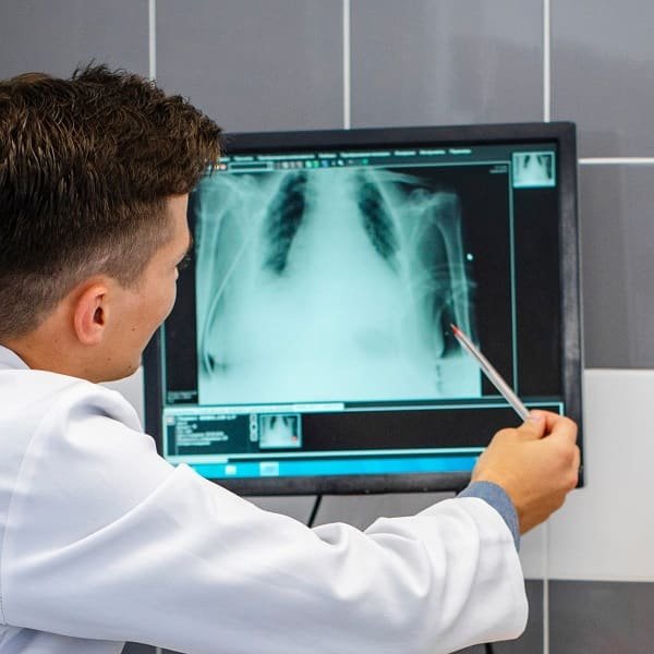 X-ray radiology reporting