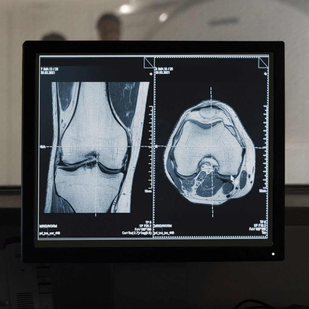 MRI telereporting