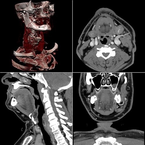 CT reporting by teleradiology