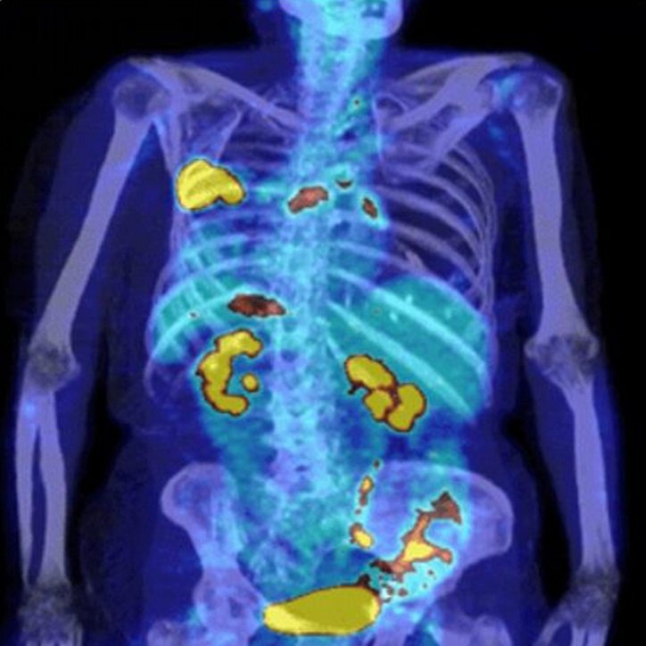 Pet-CT-telereporting