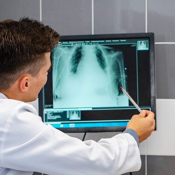 x-ray radiology reporting